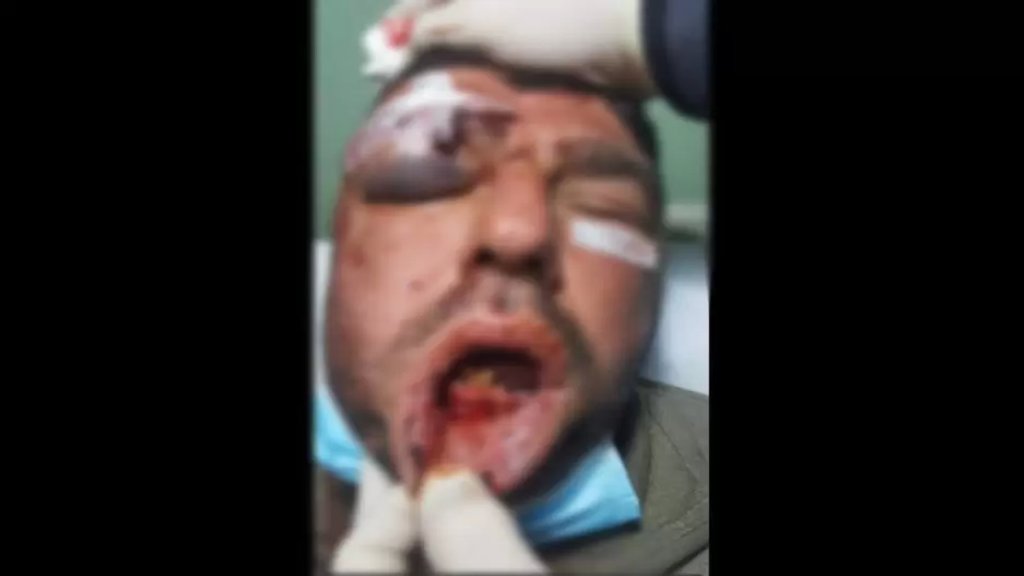 بلدية بنت جبيل تدين بشدة الاعتداء على المواطن عبد الله حرب من قبل اشخاص "متلطين خلف بدلة القوى الامنية والجيش في سوق بنت جبيل 