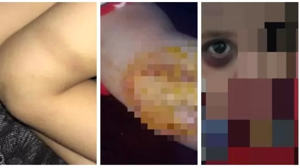  بالصور/ طفلة من الجنسية السورية تتعرض لإعتداء وحشي على يد زوجة والدها..جو معلوف تحرك حيث تم توقيف الوالد وزوجته!