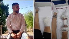 ابن حولا الجنوبية "بلال يونس" يأخذ قرار الخضوع لعملية بتر للساق بعد سنوات من الآلام و33 عملية: "صار فيي قول إني بلشت حياة طبيعية"