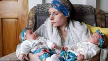أربعينية وضعت توأمين بعد تعافيها من مرض نادر.. كانت تتناول الطعام عبر انبوب خاص!