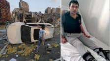 "فقدت أغلى ما أملك... يدي التي أغمر بها أولادي".. أمٌّ خسرت يدها ورب أسرة أصيب بالشلل.. إنفجار المرفأ خلّف المئات من ذوي الإحتياجات الخاصة 