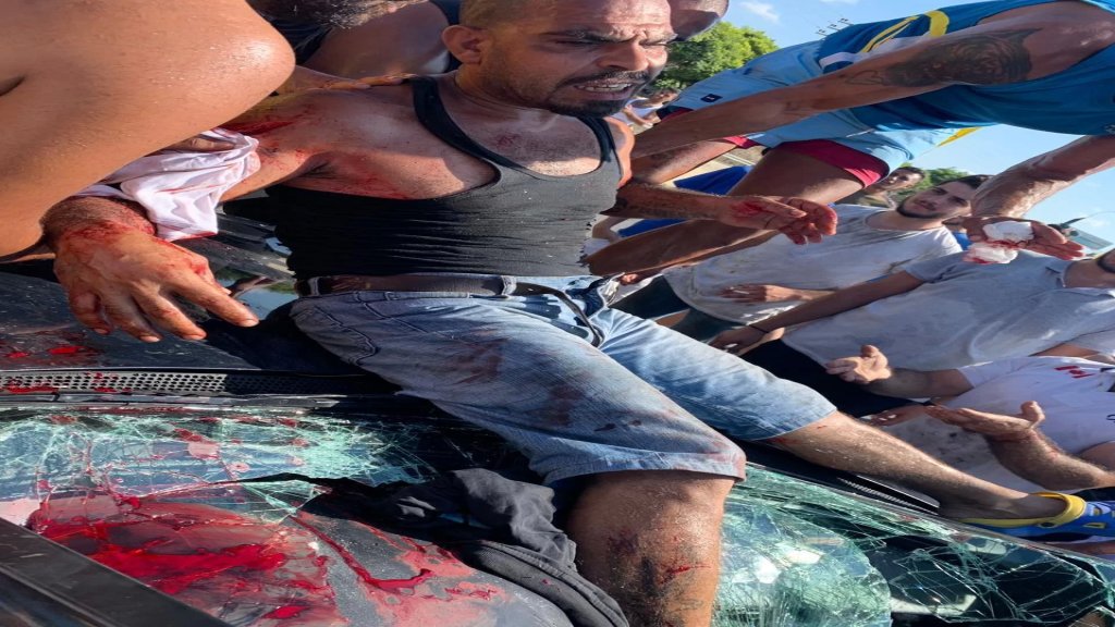 سائق سيارة يدهس أحد المحتجين بسيارته على أوتوستراد الغازية بعد أن رفض الوقوف بسبب قطع الطريق في المحلة... والشاب نقل الى المستشفى بحالة خطرة!