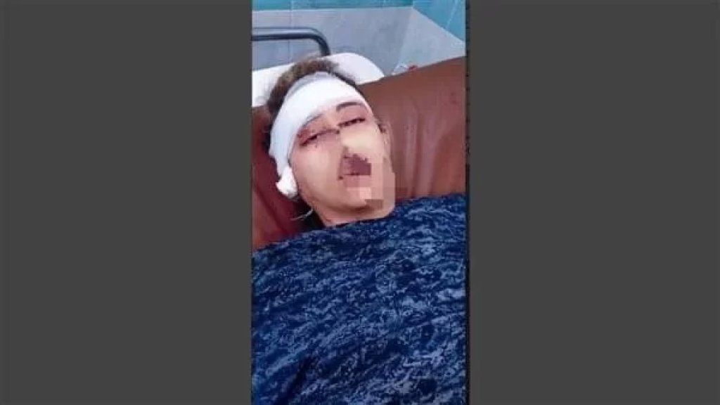 عاقبها بقطع أذنها لأنها لا تسمع كلامه.. مواطن مصري يعتدي بوحشية على زوجته!