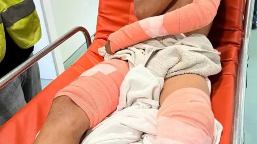 بالصورة/ كلب شارد هاجم إبن الـ 10 سنوات أثناء وجوده في منزل ذويه في بلدة كفرملكي: تعرض لعضات في كتفه ورجليه