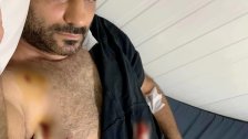 البطل الدولي "جهاد المقداد" أُصيب برصاصة طائشة في الضاحية الجنوبيّة