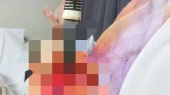حقيقة الأخبار المتداولة عن قيام سوري ببتر يد زوجته