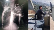 في عملية نوعية... مخابرات الجيش - أبلح توقف العامل السوري الذي حاول طعن سيدة بهدف السرقة في بلدة بياقوت