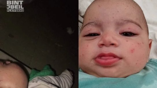 ابنةُ الشهرين ونصف بحاجة إلى علاجٍ يومي&hellip; نداءٌ إنسانيٌّ عاجل!